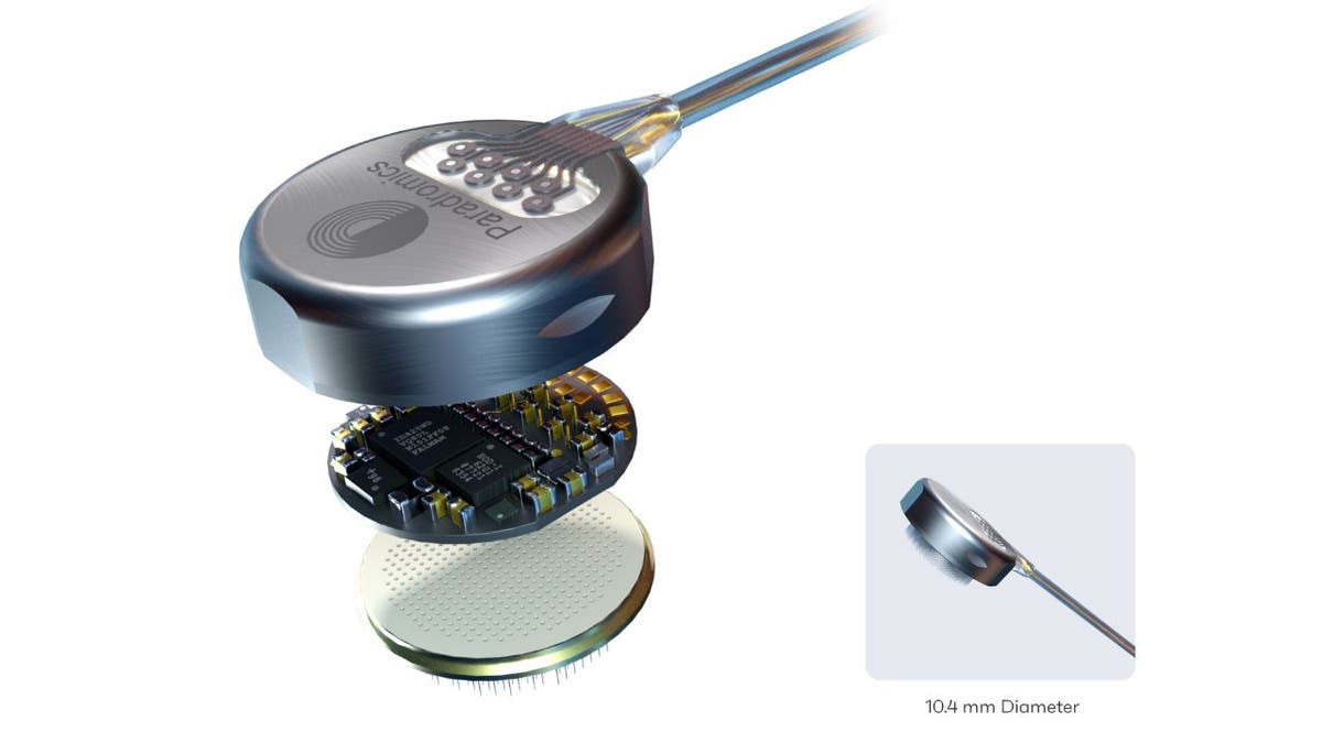 Brain implant 3